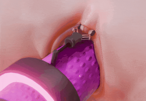 4.gif