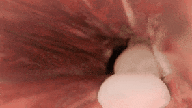 6a9ad4e3423a75.41807902.gif