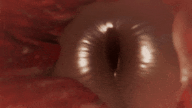 6a9ad4e3a967f4.77639058.gif